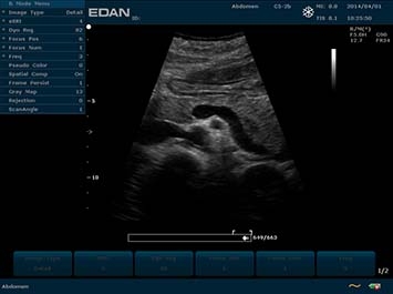 EDAN U2