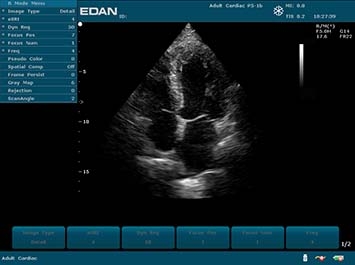 EDAN U50