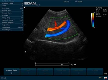 EDAN U2 VET