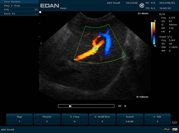 EDAN U50 VET
