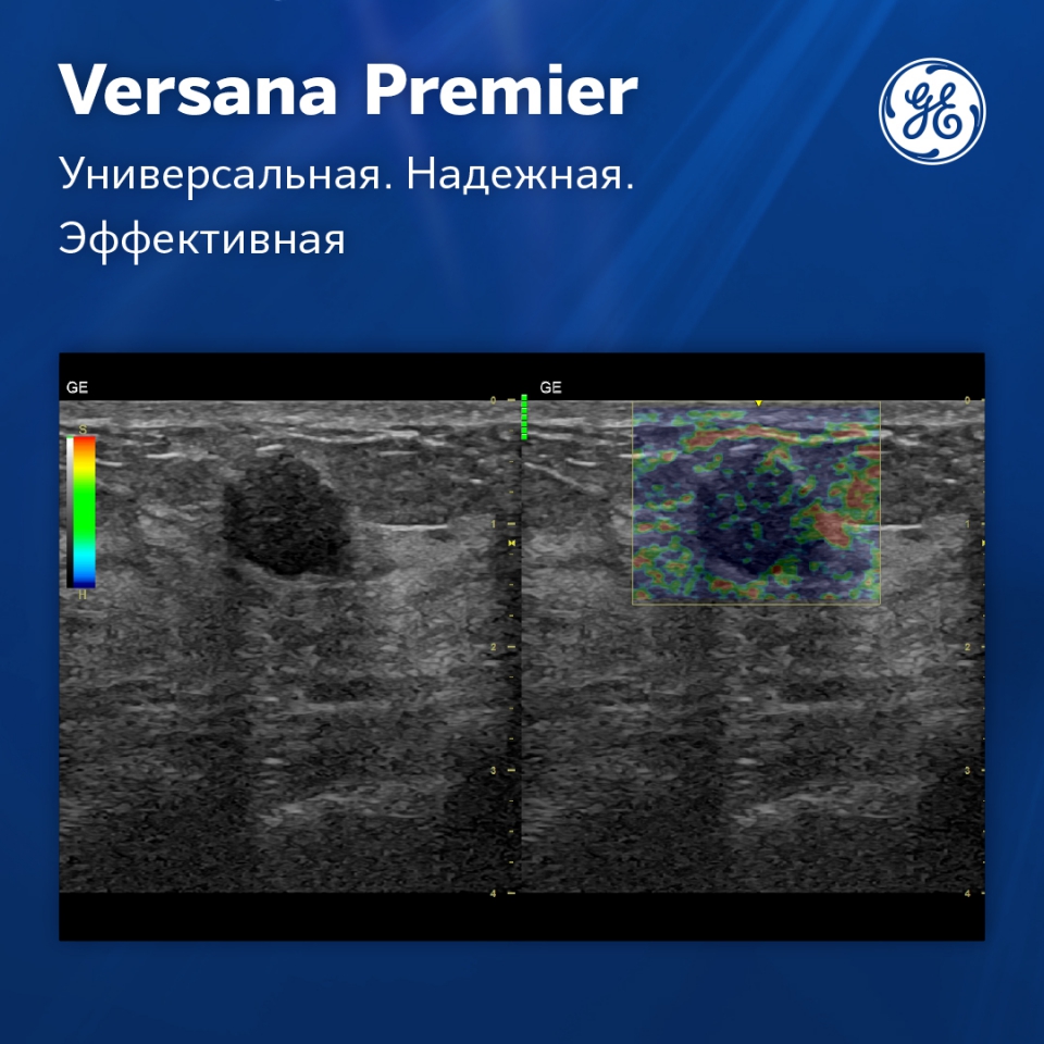 GE Versana Premier black
