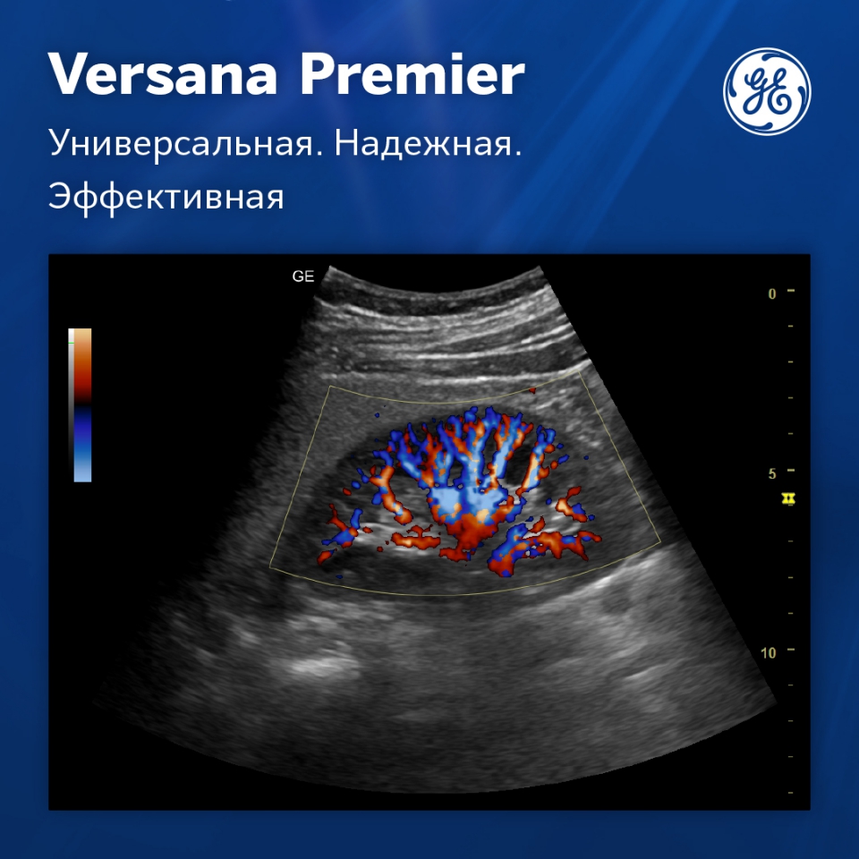 GE Versana Premier Platinum