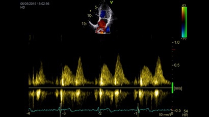 GE Vivid iq